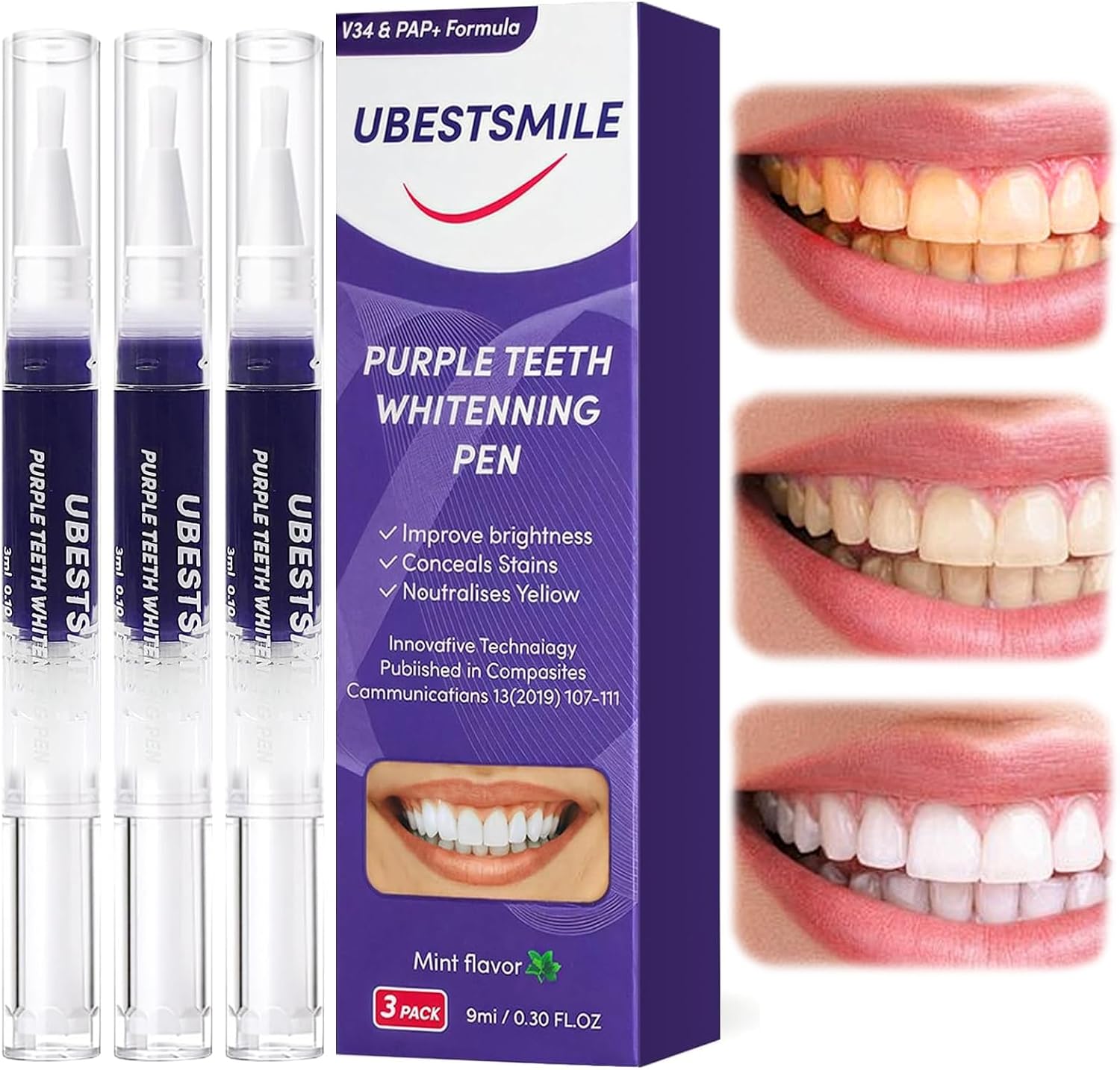 Teeth Whitening Pens - Caneta Clareadora de Dentes UBESTSMILE V34&PAP+