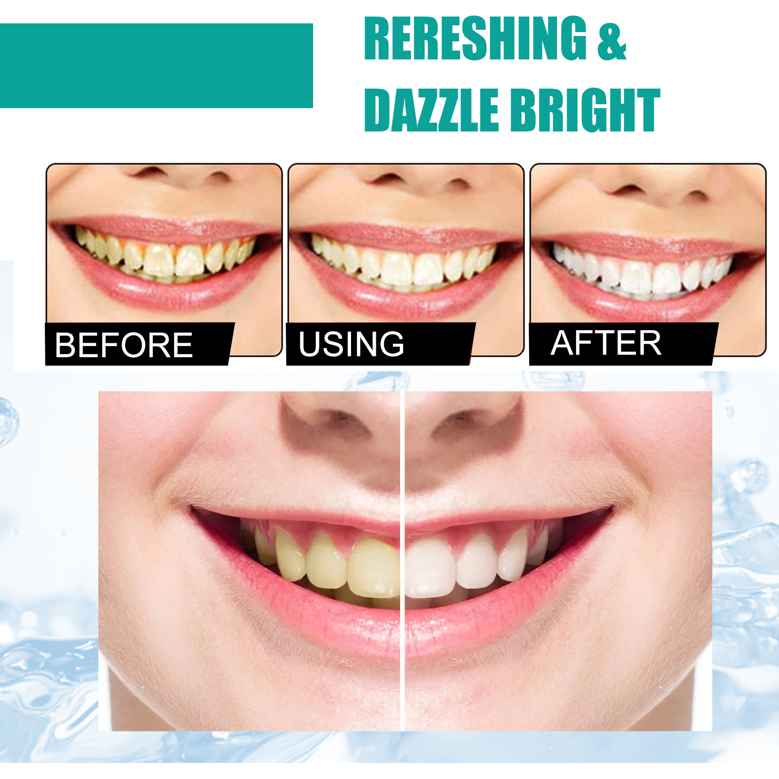 Pó de dente de hortelã, hálito - Teeth Whitening Near Me avaliação e preço