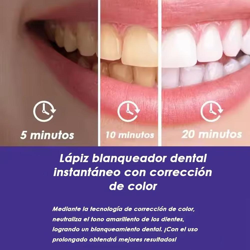 Caneta Clareadora de Dentes UB - Teeth Whitening Pens avaliação e preço