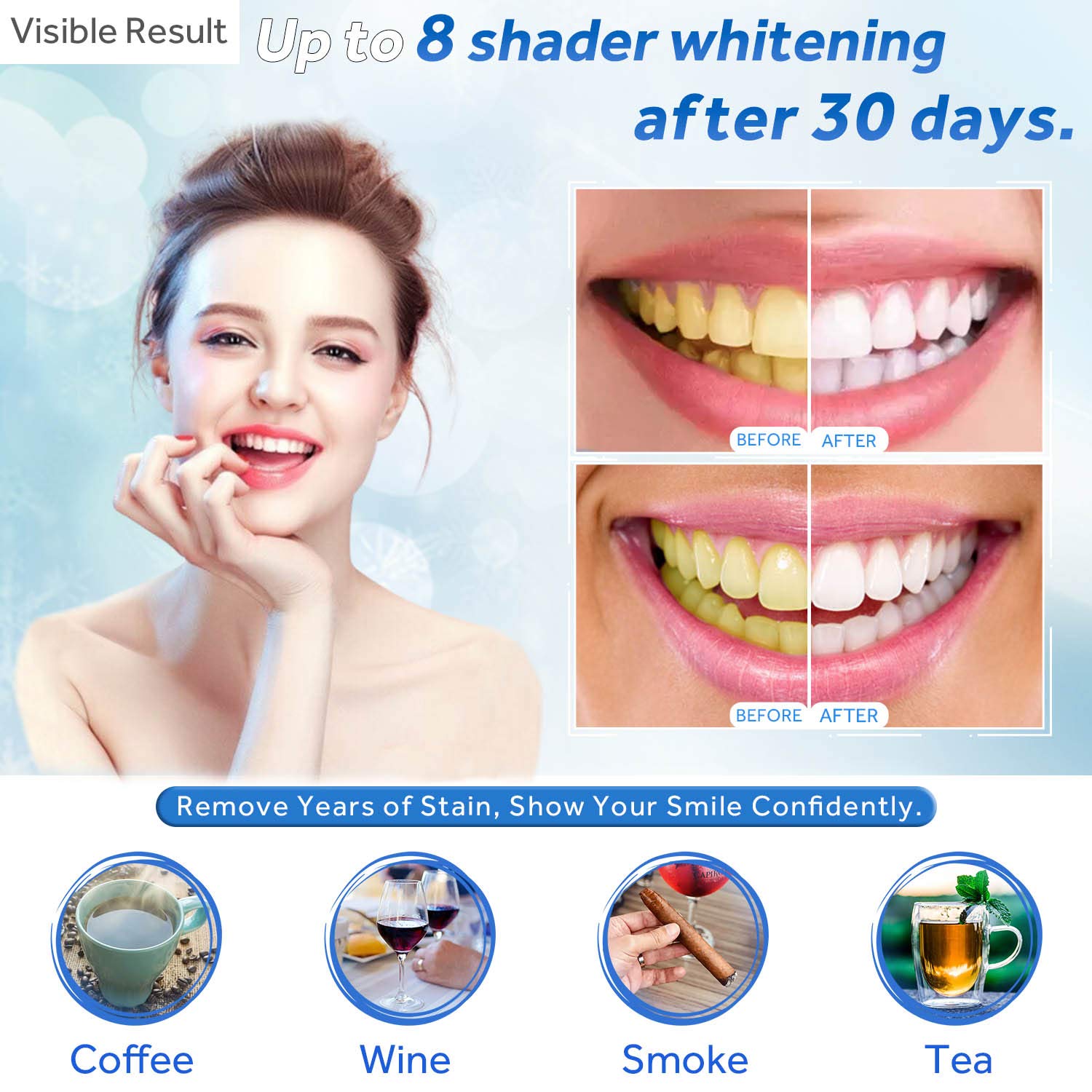 Seringa de recarga de gel para - Teeth Whitening Kit avaliação e preço