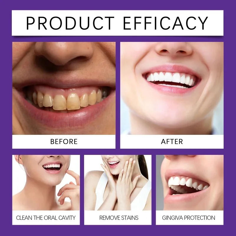 Pó Mineral Restaurador de Dent - Teeth Whitening Near Me avaliação e preço